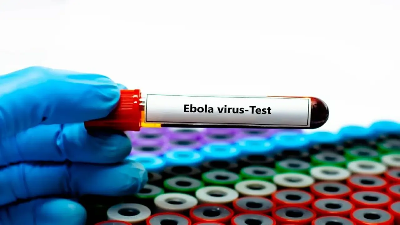 الصحة توضح: إيبولا ليس جائحة عالمية وفقًا للحقائق العلمية